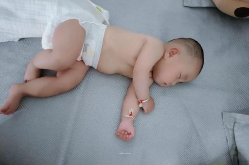 姜堰宝宝头上长痱子 姜堰宝宝头上长痱子